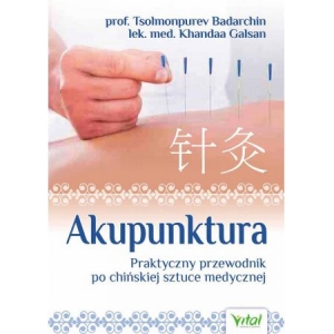 Akupunktura
